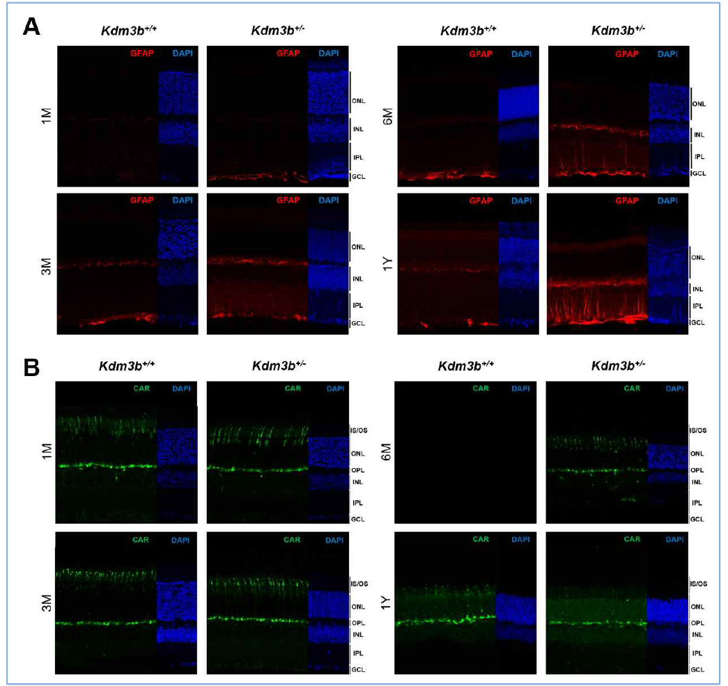 월령별 Kdm3b KO 생쥐 망막 조직의 특징 분석 (A) Kdm3b 생쥐 망막을 Muller glial 세포를 염색할 수 있는 GFAP를 이용하여 염색함. (B) Kdm3b 생쥐 망막을 원추세포(cone photoreceptor)를 염색할 수 있는 cone-arrestin (CAR) 항체로 염색하여 그 모양과 수를 관찰하였음