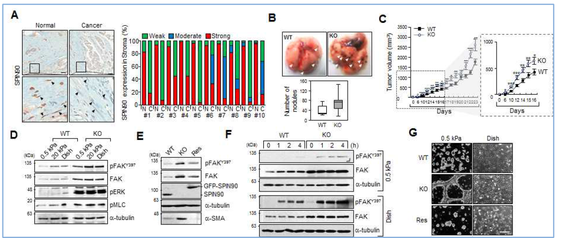 SPIN90 KO fibroblast 와 암관련 섬유아세포에서의 연관성 확인