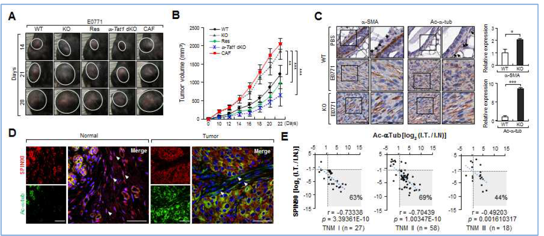 In vivo에서 SPIN90과 미세소관 아세틸화의 연관성 확인