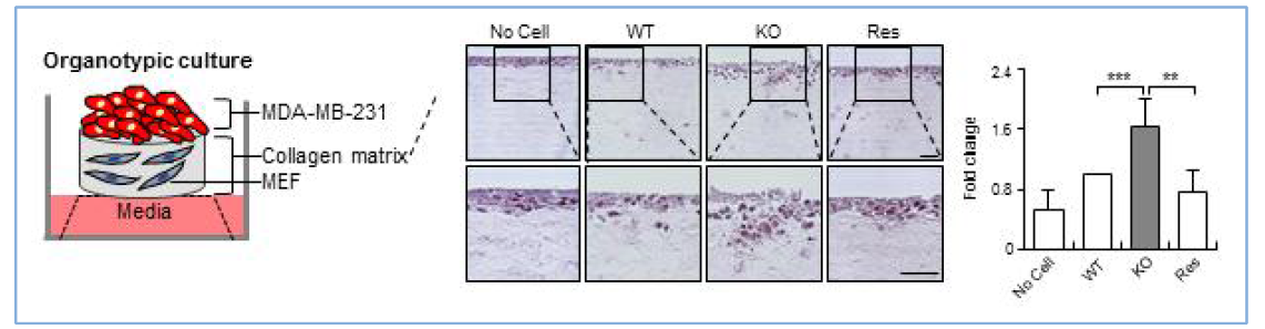 Organotypic culture를 통한 SPIN90 KO fibroblast와 암세포의 침윤능력과의 연관성 확인