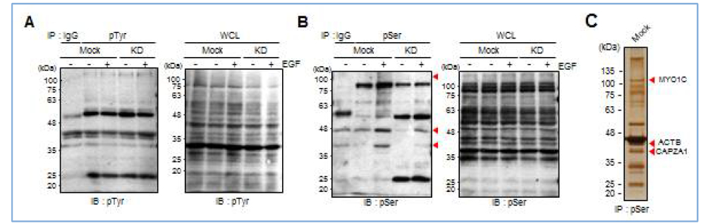 DUSP23의 발현저해의 따른 인산화 단백질의 패턴분석 및 표적단백질 동정