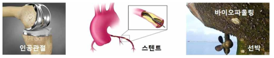 삽입형 생체재료, 인공관절(왼쪽), 스텐트(가운데), 및 선박 표면의 바이오파울링(오른쪽)