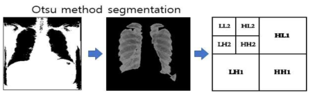 Otsu method를 이용한 폐 segmentation과 Wavelet 분류