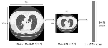 CT이미지를 Vector로 변환 전처리 작업