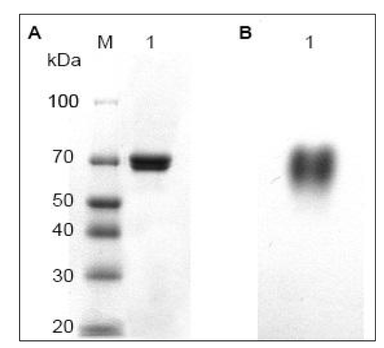 SDS(A) and Native-PAGE (B) of the melanolytic enzyme. Theculture supernatant was run under denaturing and non-denaturing conditions using 10% polyacrylamide gel and stained with coomasiebrilliant blue (A) or ABTS (B). M, molecular mass marker; lane 1, culturesupernatant