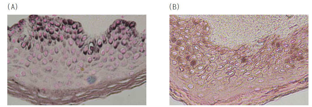 Effect of enzyme from Irpex sp. JS7 on melanin tissue from human skin. (A) Micrograph of the stained melanin by Fontana-Masson melanin stain Kit. (B) Micrograph of melanin after enzyme reaction for 48 h