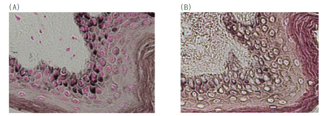 Effect of enzyme from Trametes velutina JS18 on melanin tissue from human skin. (A) Micrograph of the stained melanin by Fontana-Masson melanin stain Kit. (B) Micrograph of melanin after enzyme reaction for 48 h