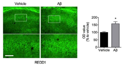 베타아밀로이드가 REDD1 발현에 미치는 영향