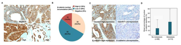 대장암 환자 101케이스에서 면역화학염색을 통한 β-catenin, Claudin-7, E-cadherin의 발현 평가 및 β-catenin 핵발현에 따른 수술 후 전이와의 연관성 분석