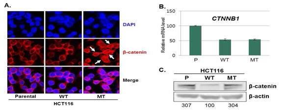 β-catenin 돌연변이(S45del)를 발현하는 대장암 세포 HCT116에서 β-catenin의 세포 내 위치 및 Wnt 신호전달계 활성화(예비연구결과1)