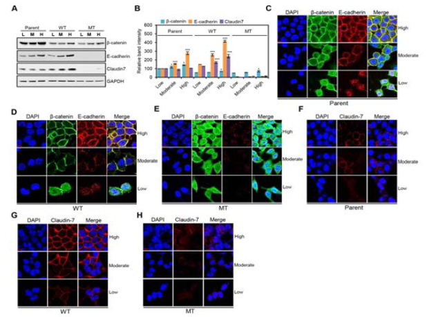 β-catenin 핵발현에 따른 Claudin-7, E-cadherin, β-catenin 발현과 TJ 및 AJ 형성