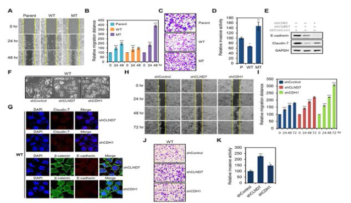 Claudin-7 knock-down에 의한 HCT116-WT 세포의 이동성 및 침윤 능력 평가