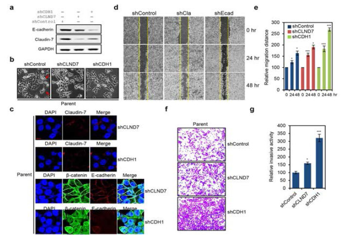 E-cadherin knock-down에 의한 HCT116-P 세포의 이동성 및 침윤능 평가