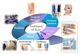 다양한 흉터치료 방법