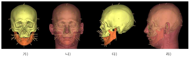 얼구피부두께 자료와 방향벡터를 이용한 얼굴두께 표현(남자, 23세). 가) 머리뼈와 피부두께기둥, 정면. 나) 실제모델과의 비교, 정면. 다) 머리뼈와 피부두께기둥, 측면. 라) 실제모델과의 비교, 측면