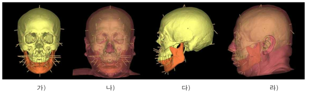 얼구피부두께 자료와 방향벡터를 이용한 얼굴두께 표현(남자, 61세). 가) 머리뼈와 피부두께기둥, 정면. 나) 실제모델과의 비교, 정면. 다) 머리뼈와 피부두께기둥, 측면. 라) 실제모델과의 비교, 측면