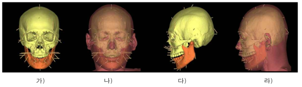얼구피부두께 자료와 방향벡터를 이용한 얼굴두께 표현(여자, 25세). 가) 머리뼈와 피부두께기둥, 정면. 나) 실제모델과의 비교, 정면. 다) 머리뼈와 피부두께기둥, 측면. 라) 실제모델과의 비교, 측면