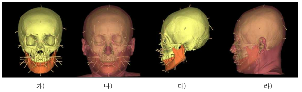 얼구피부두께 자료와 방향벡터를 이용한 얼굴두께 표현(여자, 42세). 가) 머리뼈와 피부두께기둥, 정면. 나) 실제모델과의 비교, 정면. 다) 머리뼈와 피부두께기둥, 측면. 라) 실제모델과의 비교, 측면
