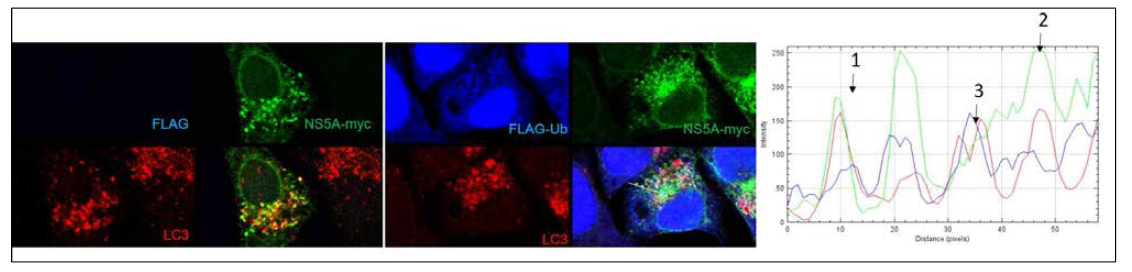 NS5A단백질이 자가포식소체로의 recruitment와 유비퀴틴 변형과의 상관 관계