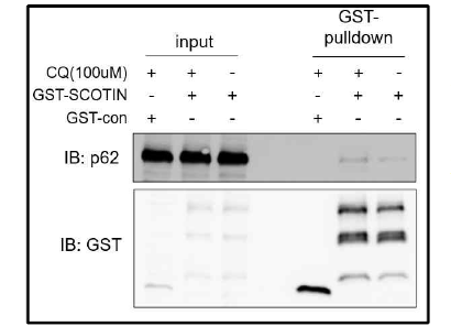 p62와 SCOTIN 간의 물리적 결합과 CQ처리에 의한 변화 확인