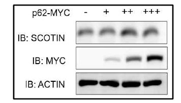 p62 과발현에 의한 SCOTIN 단백질 양의 변화 확인