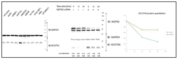 다양한 자가포식수용체 중 NDP52 단백질 knockdown 특이적 SCOTIN 단백질의 양변화 및 자가포식분해 조절