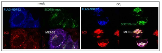 SCOTIN-LC3-NDP52단백질 puncta pattern의 co-localization