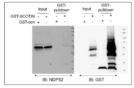 SCOTIN단백질과 자가포식소체 NDP52의 결학 확인