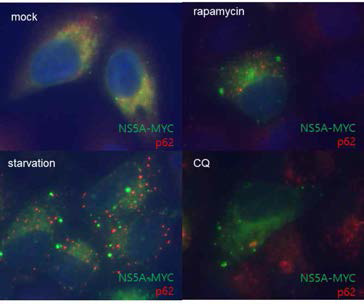 자가포식작용 유도 및 자가포식소체 증가조건에서의 p62와 NS5A의 위치 확인