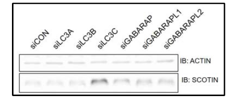 자가포식 막 단백질 LC3(LC3A, LC3B, LC3C, GABARAP, GABARAPL1, GABARAPL2)에 의한 SCOTIN 단백질 양 변화 확인