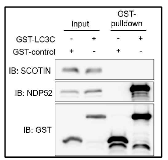 LC3C와 SCOTIN 간의 물리적 결합여부 확인