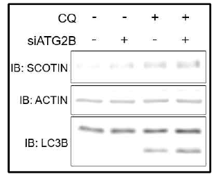 ATG2B knock down에 의한 SCOTIN 단백질의 양의 변화