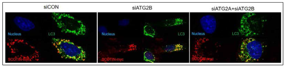 ATG2B 또는 ATG2A/2B knockdown에 의한 SCOTIN의 자가포식소체로의 이동 변화