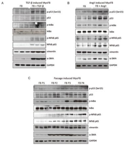 근섬유아세포에서 p53 및 NF-κB의 활성화
