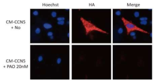 엔도시토시스 (Endocytosis) 저해제에 의한 CCN5의 세포 내로의 이동 억제