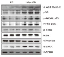근섬유아세포 (MyoFB)에서 p53 및 NF-κB 신호전달계의 활성화