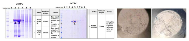 SDC-PDGFR 키메라 단백질의 결정화 과정 His-tagging을 활용하여 단백질을 정제 한 후 size exclusion gel chromatography를 추가 분리 후 단백질 sequencing을 통해 확인하고 192가지 buffer에 screening하고 x-ray회절 테스트를 수행함