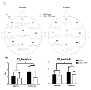 ERPs analysis in auditory oddball paradigm