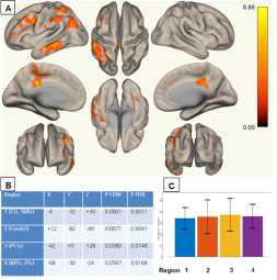 Resting state fMRI