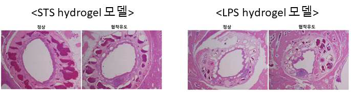 hydrogel을 이용한 협착유도 확립