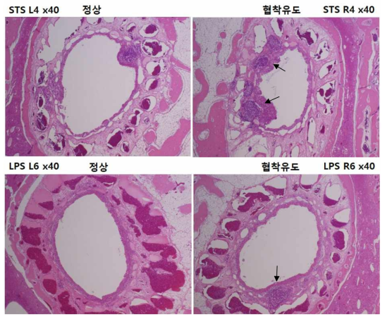 STS 및 LPS를 이용한 토끼 코눈물관의 협착 유도