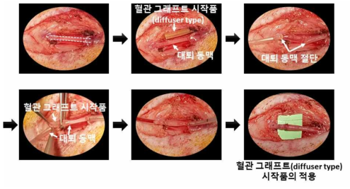 고분자 기반 혈관 그래프트(diffuser type) 시작품의 적용