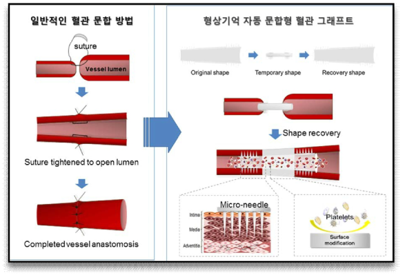 형상기억 혈관 그래프트 개발 모식도