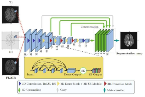 뇌 MRI 영상분할을 위한 제안된 3D-SkipDenseSeg Network 구조