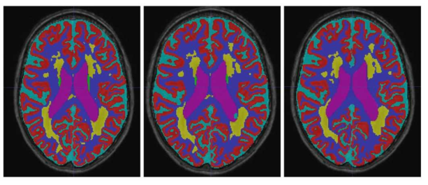 MRBrainS18 데이터를 이용한 segmentation 결과 (without adversarial, with adversarial, ground-truth image)