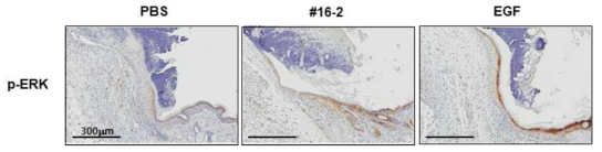 급성창상 동물모델 조직에서 SIS-1 316-2에 의한 표피세포의 ERK 인산화 증가 확인