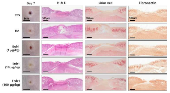 원천물질 Erdr1의 피부 재생 효과 및 함몰형 흉터 방지 효능