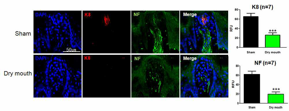대조군과 비교하여 구강건조증 마우스 모델에서 케라틴 분화표지인자 발현 분석