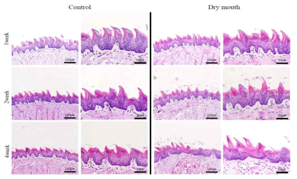 구강 건조증 모델에서 혀 상피조직의 형태 및 각질층의 변화 결과