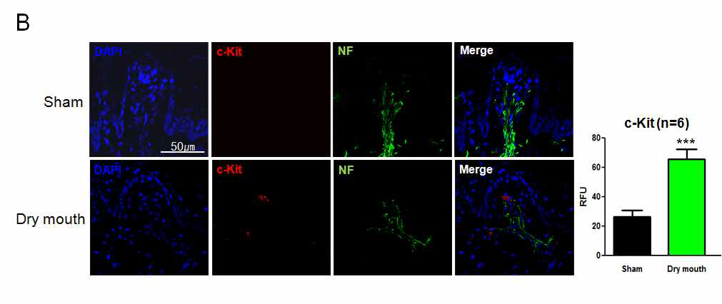 대조군과 비교하여 구강건조증 마우스 모델에서 c-Kit 분화표지인자 발현 분석